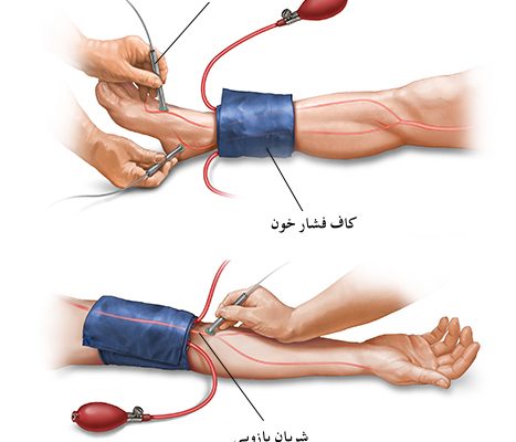 ارزیابی عروق در بیماران دیابتی