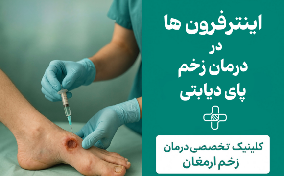 اینترفِرون‌ها