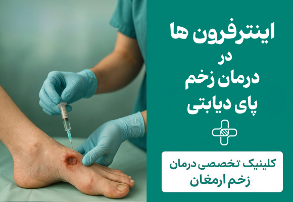 اینترفِرون‌ها