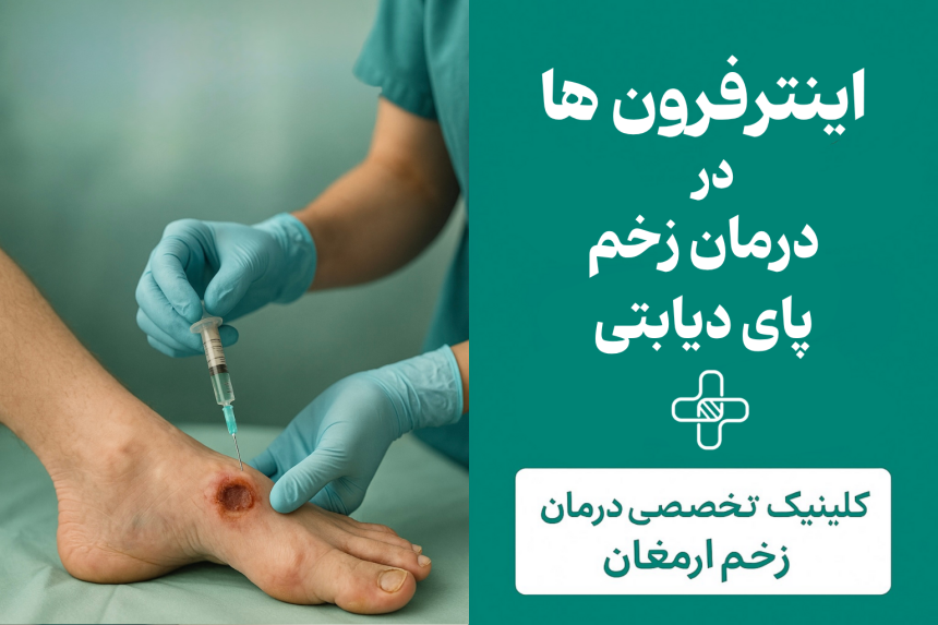اینترفِرون‌ها
