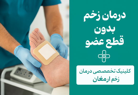 درمان زخم دیابتی بدون قطع عضو
