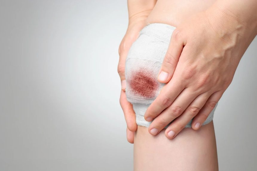 چرا زخم پای دیابتی چرک می‌کند و بوی بد می‌دهد؟