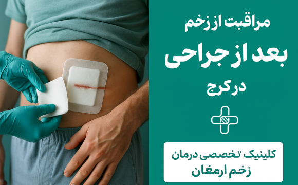 مراقبت از زخم بعد از جراحی در کرج