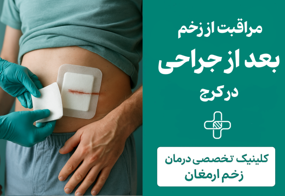 مراقبت از زخم بعد از جراحی در کرج