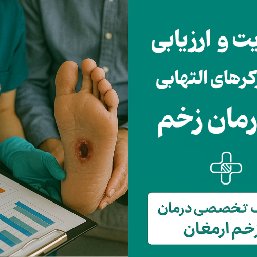 درمان زخم پای دیابتی