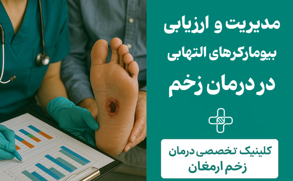 درمان زخم پای دیابتی