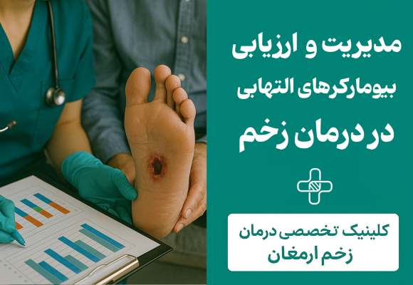 درمان زخم پای دیابتی