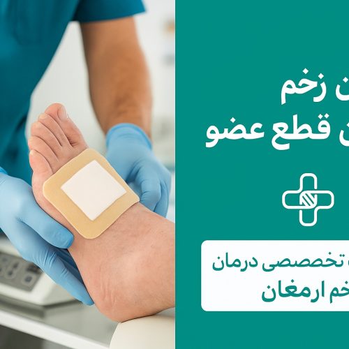 درمان زخم دیابتی بدون قطع عضو در کرج