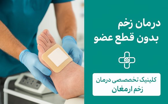درمان زخم دیابتی بدون قطع عضو در کرج