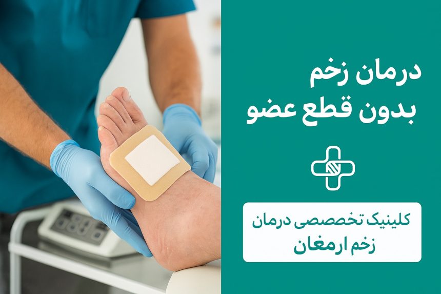 درمان زخم دیابتی بدون قطع عضو در کرج