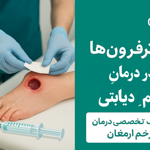 اینترفِرون‌ها در درمان زخم‌ها دیابتی