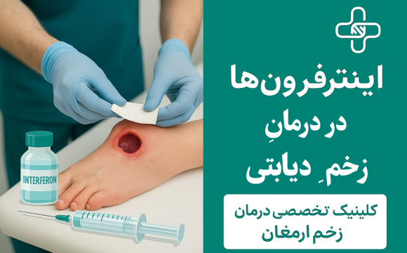 اینترفِرون‌ها در درمان زخم‌ها دیابتی