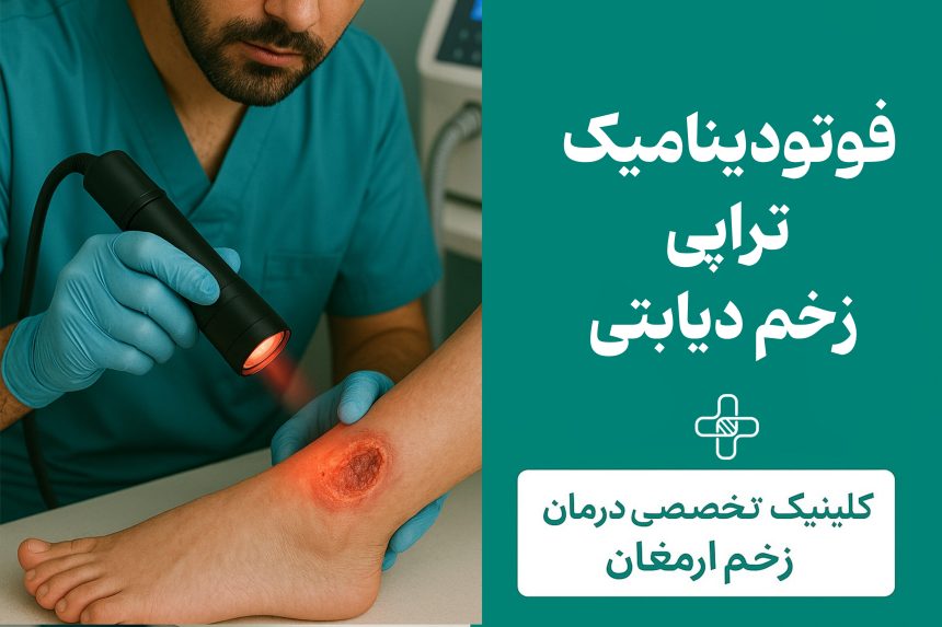 فتودینامیک‌تراپی