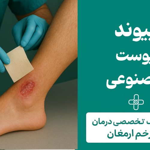پیوند پوست مصنوعی