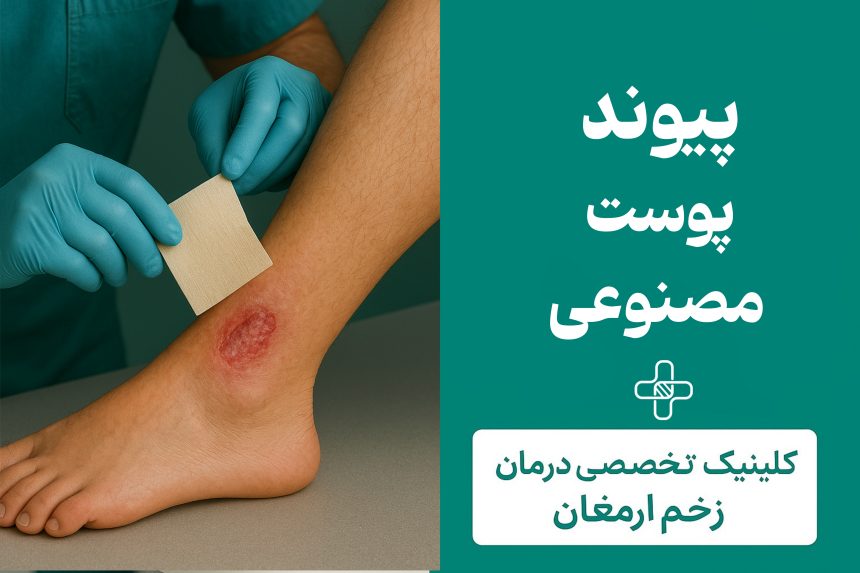 Title - 26 پیوند پوست مصنوعی