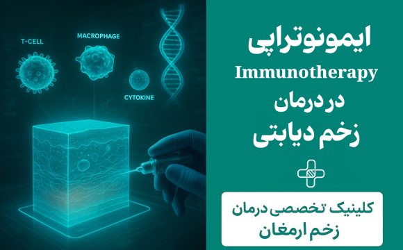 ایمونوتراپی