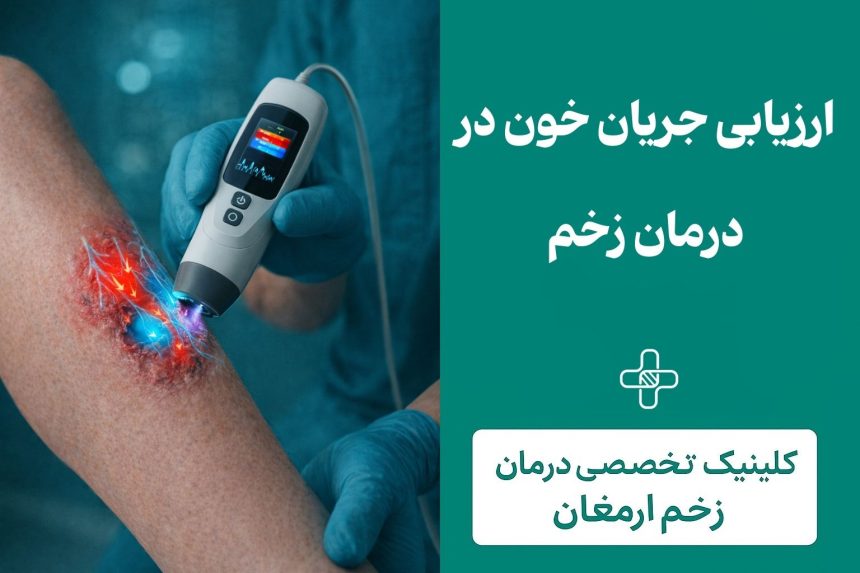 ارزیابی جریان خون در درمان زخم