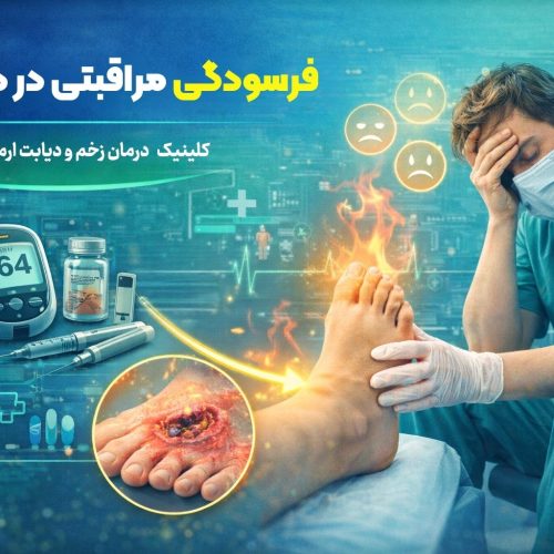 فرسودگی مراقبتی