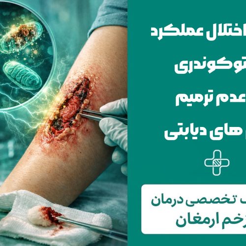 نقش اختلال عملکرد میتوکندری در عدم ترمیم زخم‌های دیابتی