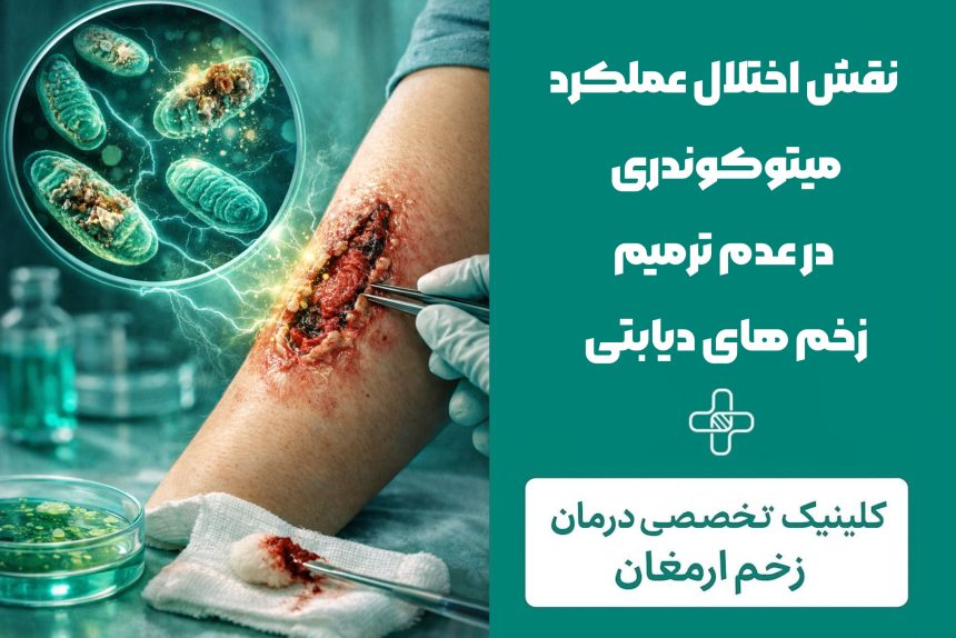 photo-output نقش اختلال عملکرد میتوکندری در عدم ترمیم زخمهای دیابتی