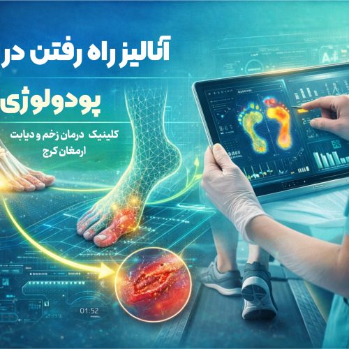 آنالیز راه رفتن در پودولوژی پودولوژی