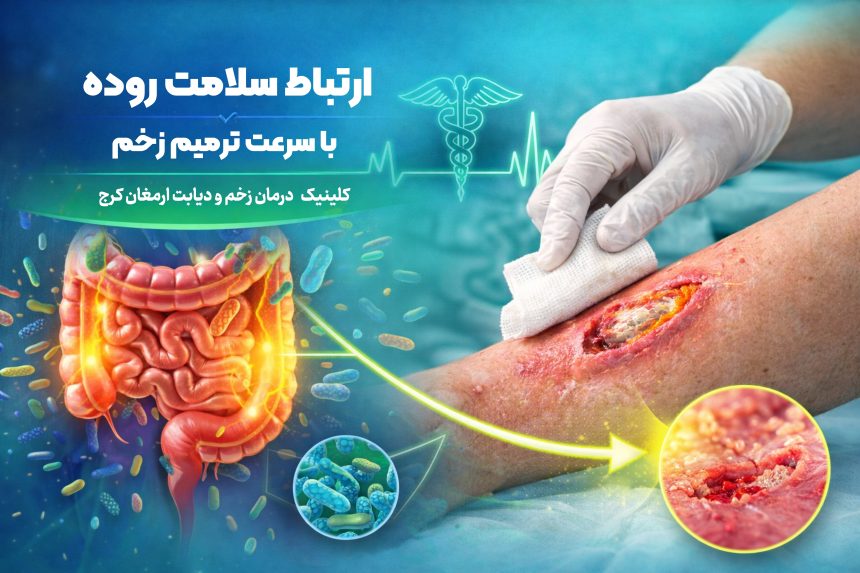 روده