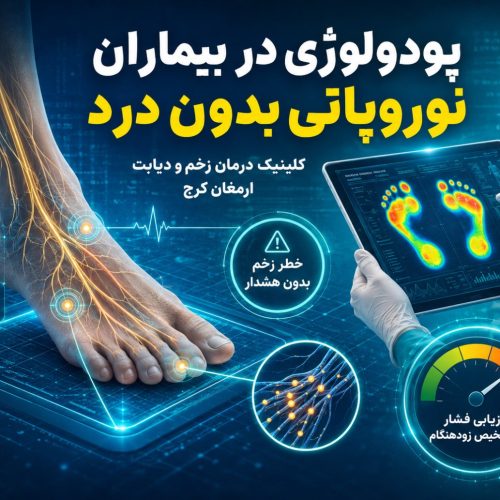 نوروپاتی