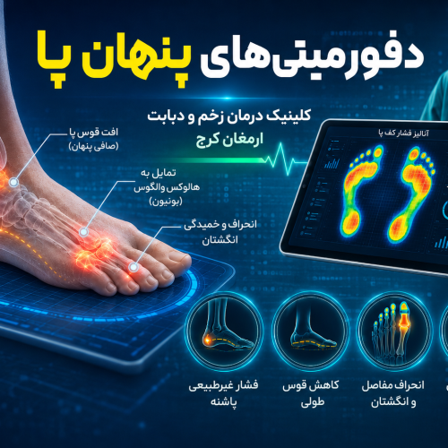 دفورمیتی
