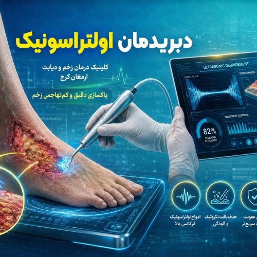 دبریدمان