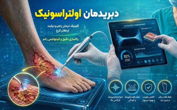 دبریدمان