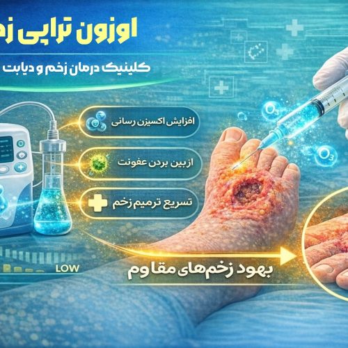 اوزون تراپی