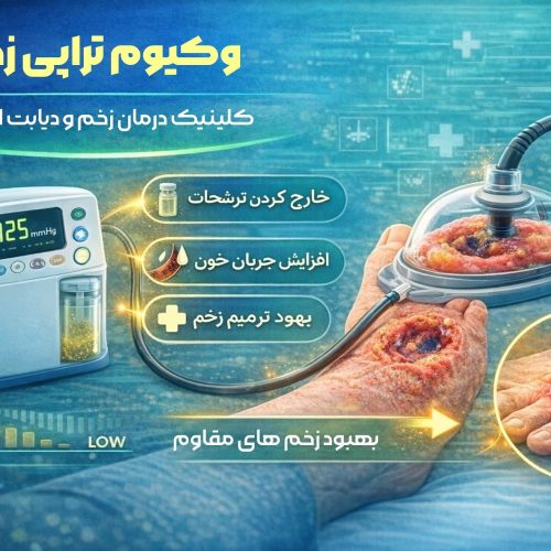 وکیوم تراپی
