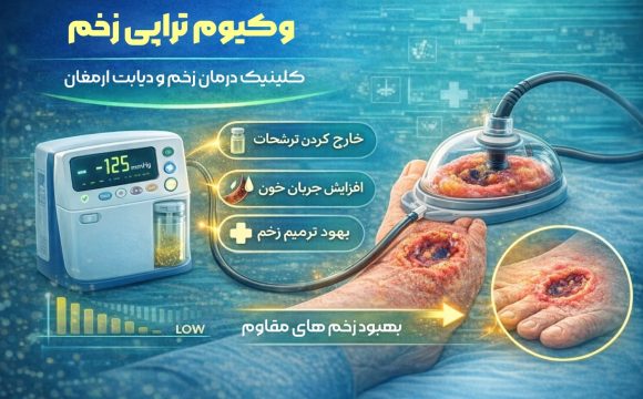 وکیوم تراپی