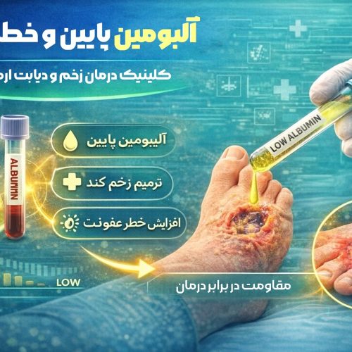آلبومین