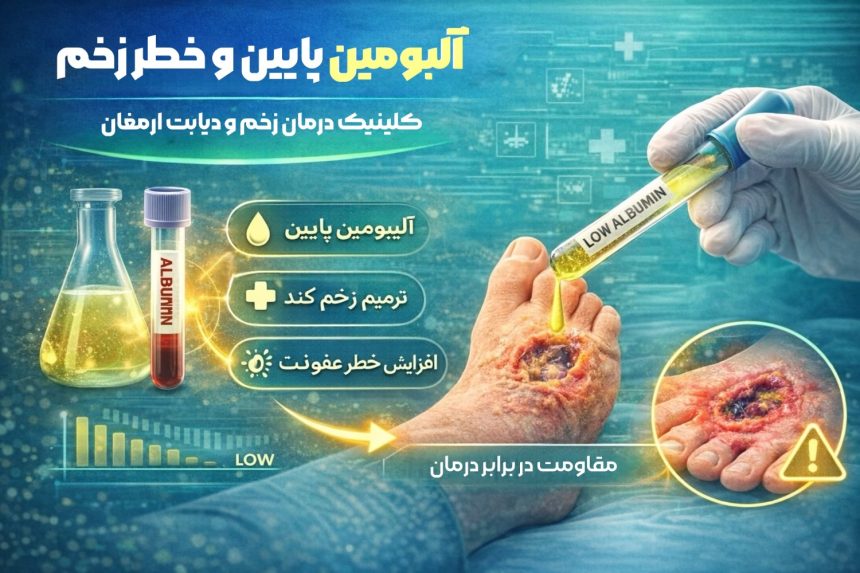 آلبومین