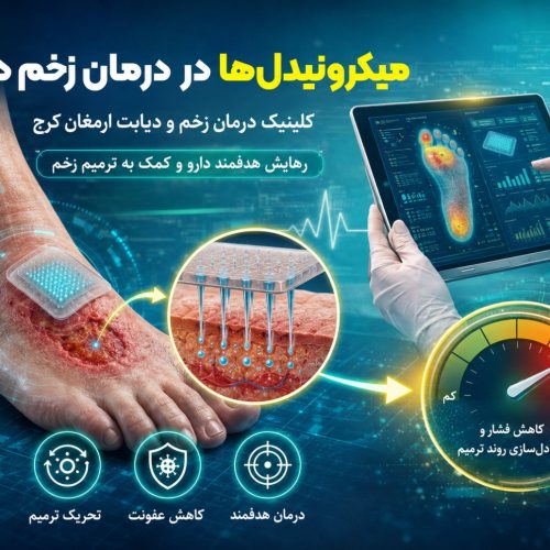 میکرونیدل‌ها