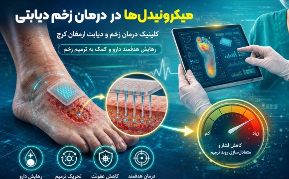 میکرونیدل‌ها