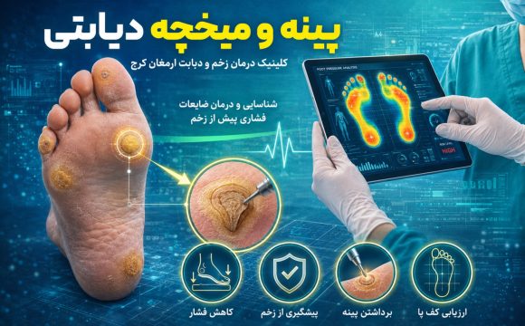 پینه و میخچه در بیماران دیابتی