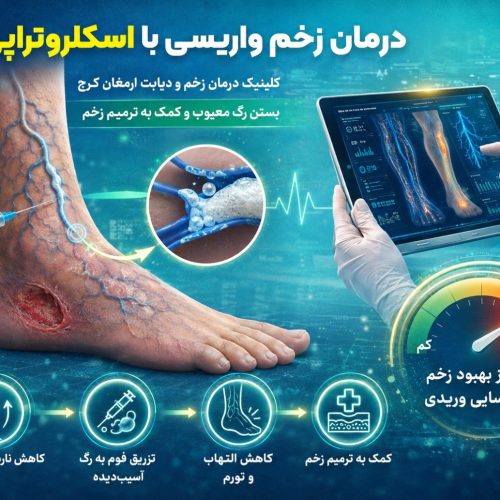 اسکلروتراپی